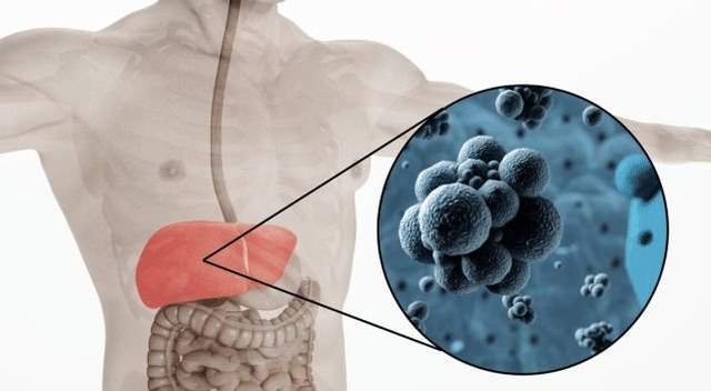 方法|62岁阿婆,大三阳转阴只用了3年,3个方法值得借鉴