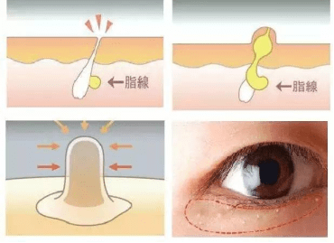 毛周|学生党常见的皮肤问题，首先分清症状，再谈正确护肤