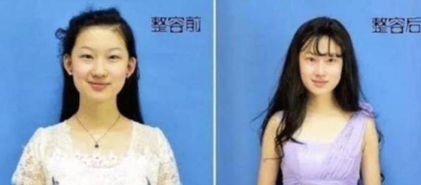 名字|19岁花百万整容成刘亦菲，名字也像高仿刘亦菲，如今23岁成了这样