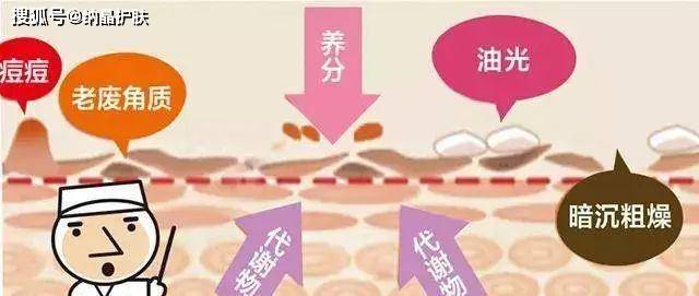 进行|夏日烂脸，满是痘印，新手小白在家可以刷酸焕肤吗？
