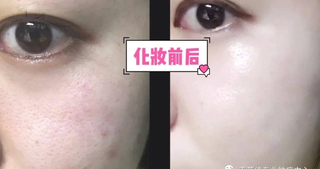 姐妹|痘痘肌化妆教程，小心机已经收藏了！