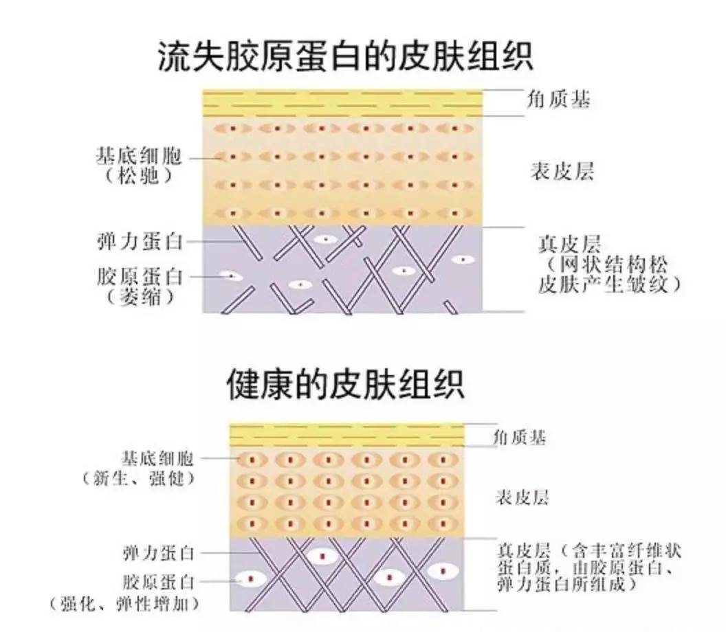 成分|爱兰诗 | 想要皮肤不老，水嫩饱满有弹性，胶原蛋白Ⅲ型必不可少！