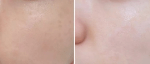 人群|这几款专门为油痘肌研发的洗面奶:好用到15天内回头囤了6瓶...