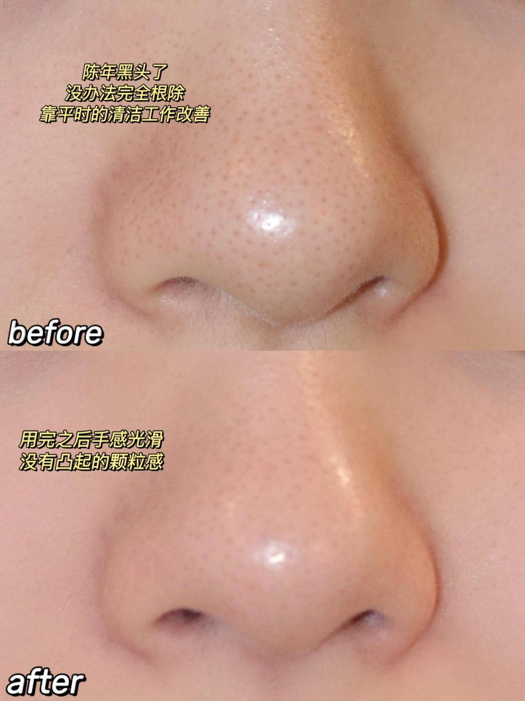 xx|定期去角质是必要的,但保护角质比去角质更重要!