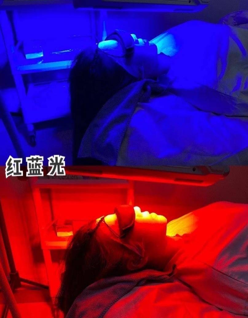 果酸|油痘肌3年祛痘经验，告诉你油痘肌皮肤适合哪些医美？