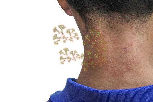 能力|体内有癌，皮肤告知？身体3处皮肤异常，警惕肝癌或正在靠近！