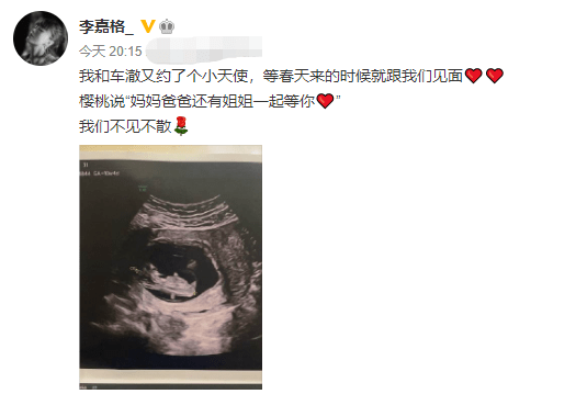 夫妻俩|李嘉格官宣即将生二胎，总裁老公陪伴医院产检，夫妻俩很幸福