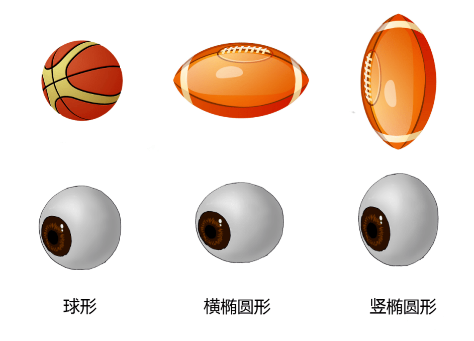 右眼|西安市第一医院｜医学科普：“散光”的理解
