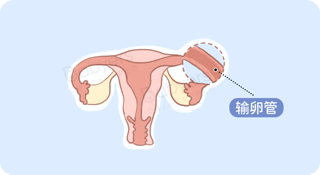 子宫|输卵管一堵，精子卵子都要哭！
