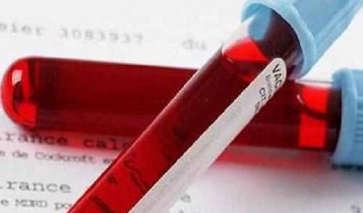 治疗|当肌酐开始升高，我们能做些什么？