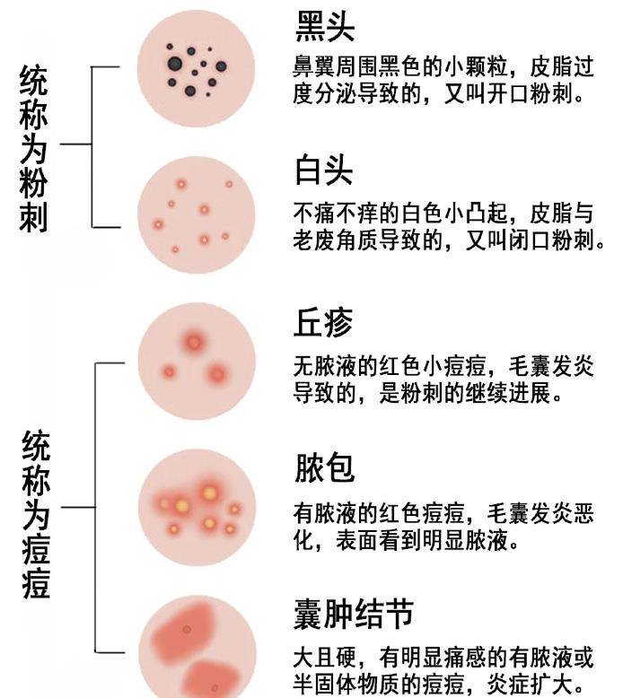 祛痘|粉刺没了、痘痘走了，冬日这几招，能让你脸变得白净又光滑