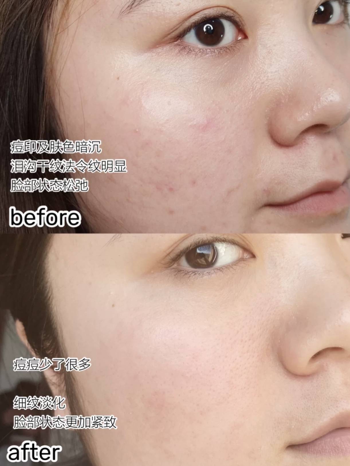 要求|兼顾“清爽保湿抗老”多要求的夏日面霜，即使大油田也能自由呼吸