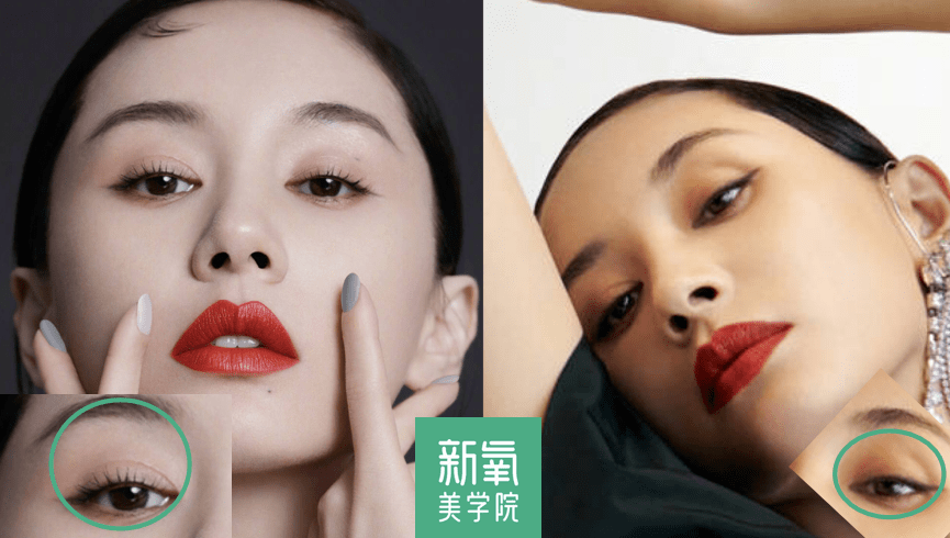 眉骨|给赵露思换了天使大宝贝的眉骨和眼眶骨，这张脸洋气指数飙升120%