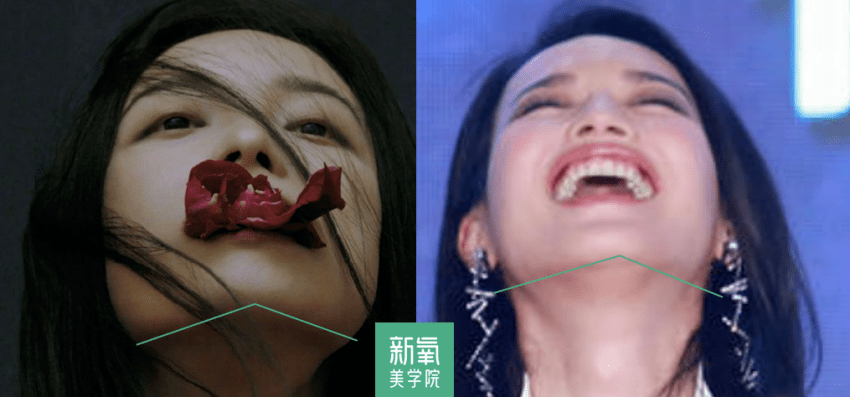 眉骨|给赵露思换了天使大宝贝的眉骨和眼眶骨，这张脸洋气指数飙升120%