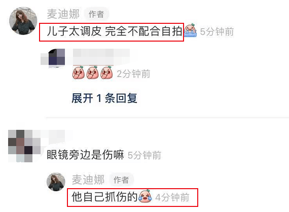 丹尼尔|麦迪娜孕晚期坚持工作，还将2岁儿子带身边，丹尼尔顽皮抓伤自己