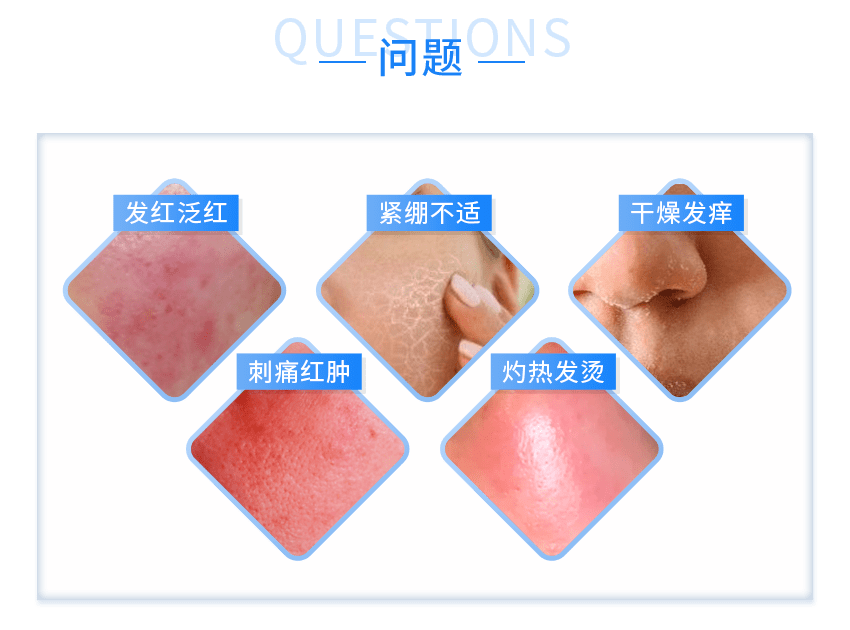 功能|《水初语莹莹护肤课堂》痘痘看1，敏感看2，斑点看3