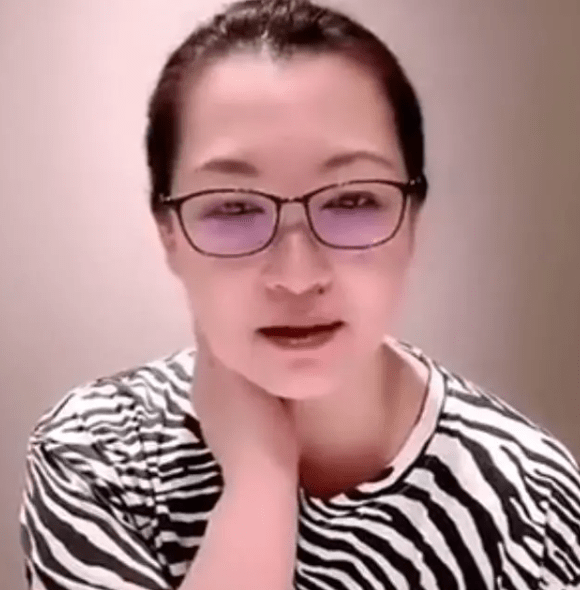 脸部|球球直播整容旧照，吐槽打针脸有一米长，亲妈都忍不住吐槽！
