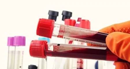 血管|血糖高的人，出现5种表现，小心并发症！控血糖，做好4件事