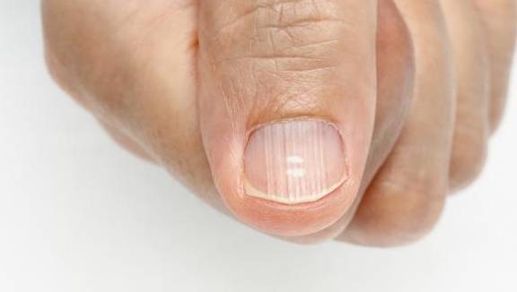 肝脏|肝癌多是“拖”出来的，4个部位出现异常，可能是肝病来袭