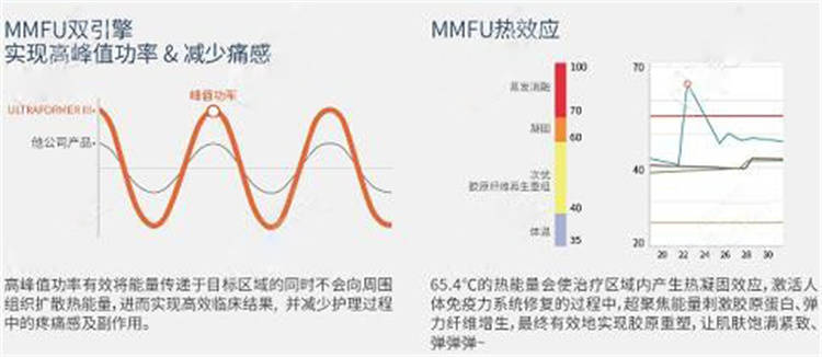 mm|做了7d聚拉提没效果是因为7d聚拉提做完注意事真的忽略了？