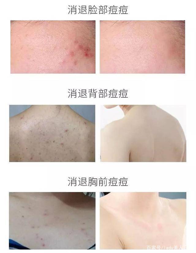 因为|26岁昆凌美背撩人，上万衣裙藏不住凹凸感，俩娃妈不简单