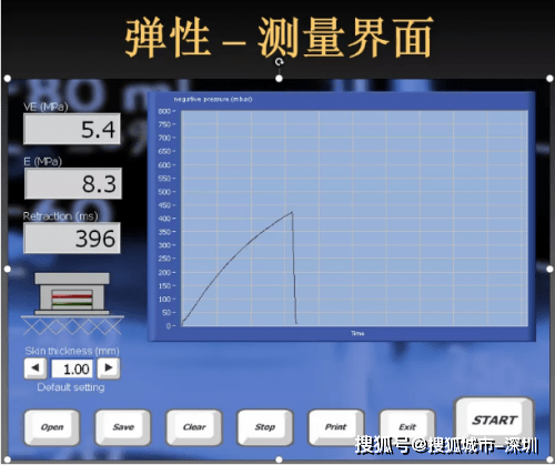 治疗|皮肤胶原流失多少，丹麦皮肤超声告诉你！