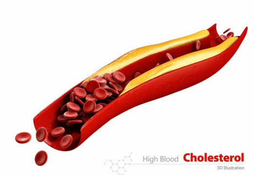 血脂怎么调理才会降 ddf75ae4c2ae42d09bd10626d3813c70.png