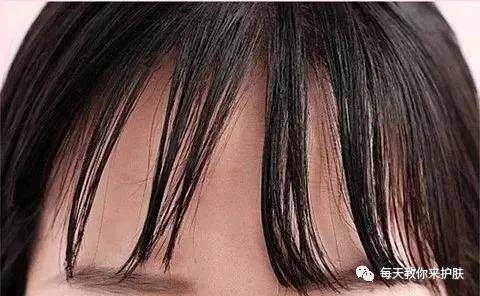 Father's|毛孔粗大，痘痘 可不止爱出油那么简单