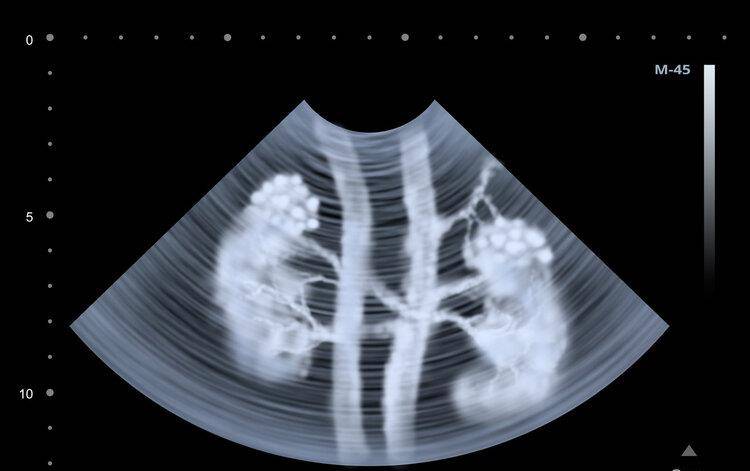 症状|肾不好,能吃水果吗?听一句劝:这些食物别贪吃,肾会感谢你