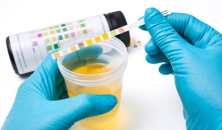 肾脏|肾功能受损有哪些征兆?提醒:除了泡沫尿,这6种症状也别大意