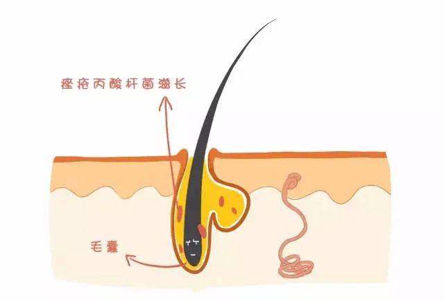 产品|护肤猛药维A酸不敢随便用，衍生物了解一下~