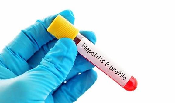 要求|患上乙肝后别灰心，饮食上要有要求，坚持这5个饮食原则