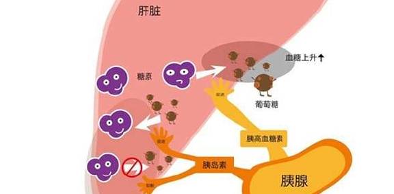 症状|血糖高的还有这些早期症状，没几个人知道