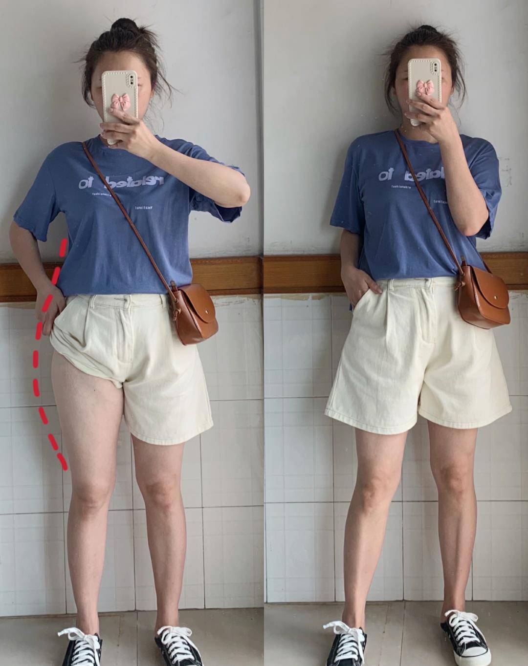 大腿|女星沈月从土肥圆到日系美少女，她到底do了哪里？