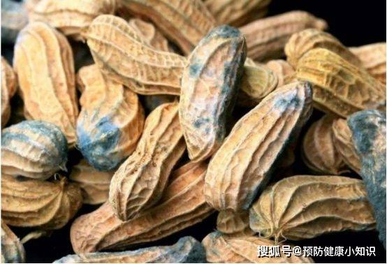 食物|全身出现7种信号时,肝脏或已“硬如石头”,医生:快来做肝检查