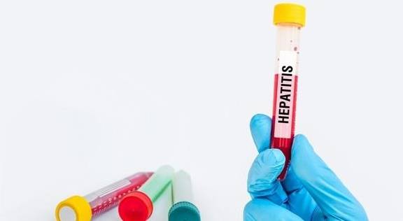 治愈|乙肝“大三阳”和“小三阳”哪个更严重？出乎意料！