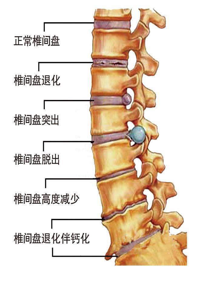 描瑶古方 如果不重视这个症状