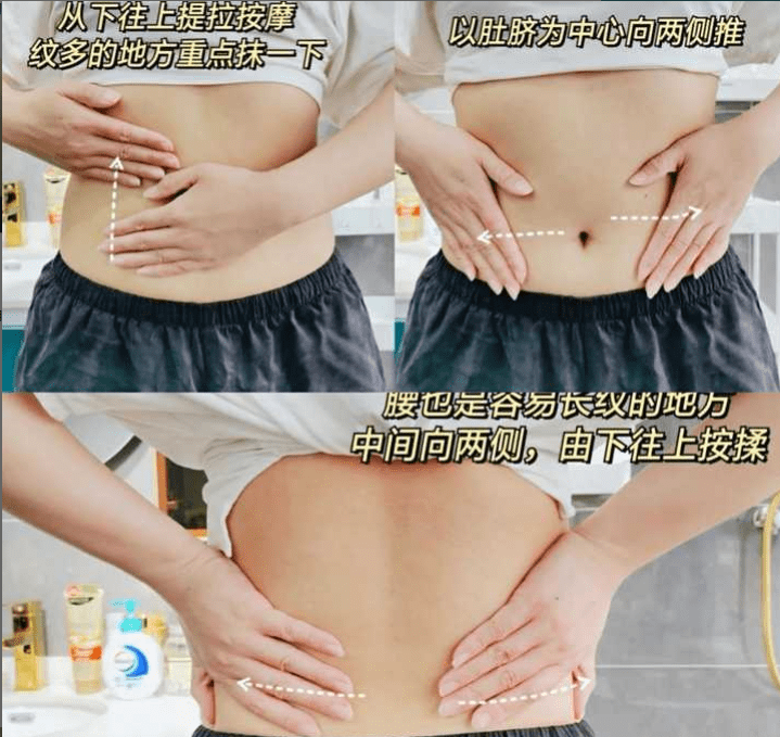 体重|不想长妊娠纹？坚持做对4件事，妊娠纹都会绕着你走！医生都夸好