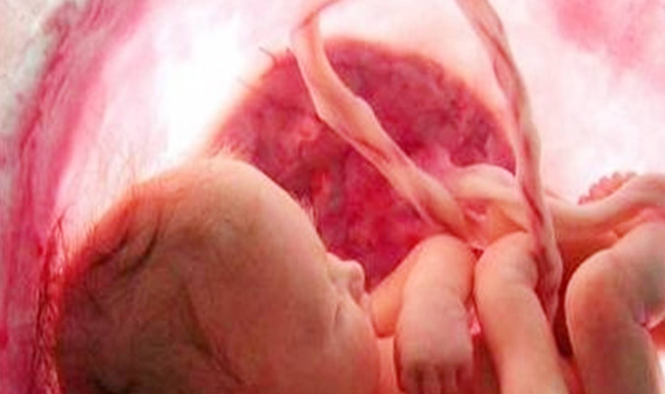 头胎|产检时医生为何会问“头胎还是二胎”？并非没事找事，答案很重要