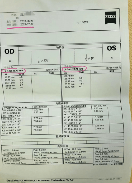严宏|【角膜塑形镜案例】宜昌8岁近视女孩的角膜塑形镜之路！