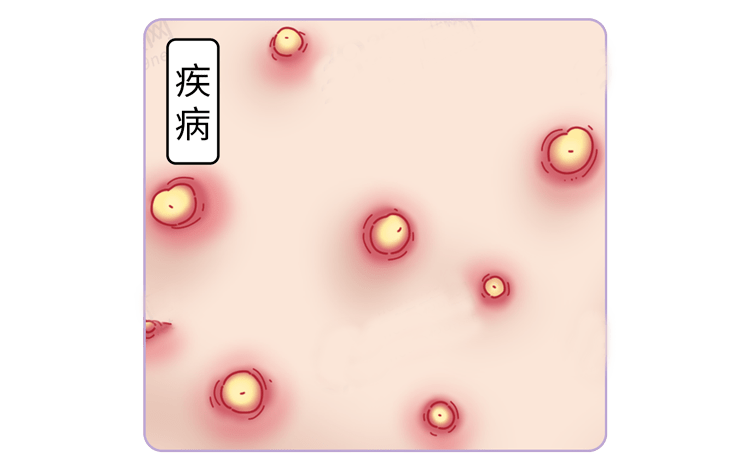 头皮|早上洗完头，下午就出油？归根结底，原因在这！