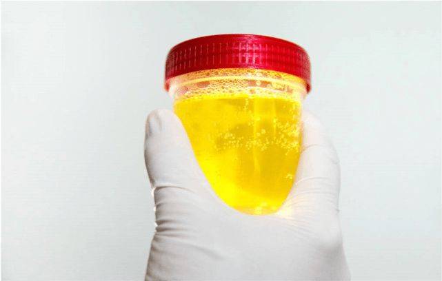 空腹|糖尿病的“死敌”被揪出，不是苦瓜，若你爱吃，降糖控糖，胰岛会感谢你