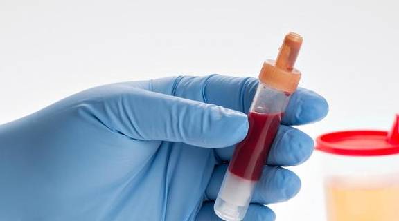 症状|肾衰竭早期,6大“信号”会异常“凸显”,却常常被忽视!