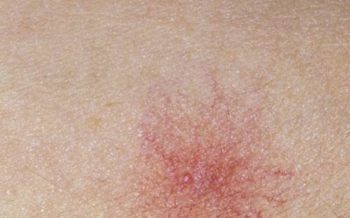 肝脏|肝脏变硬时，身体会有4个异常，一个没有，说明你的肝脏还算健康