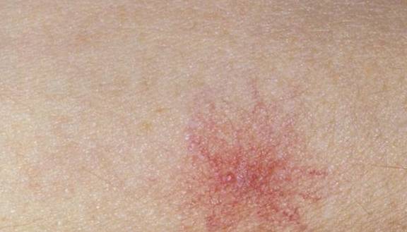 肝脏|中医提醒：肝脏受损，身体3个表现“藏不住”，很多人不在意