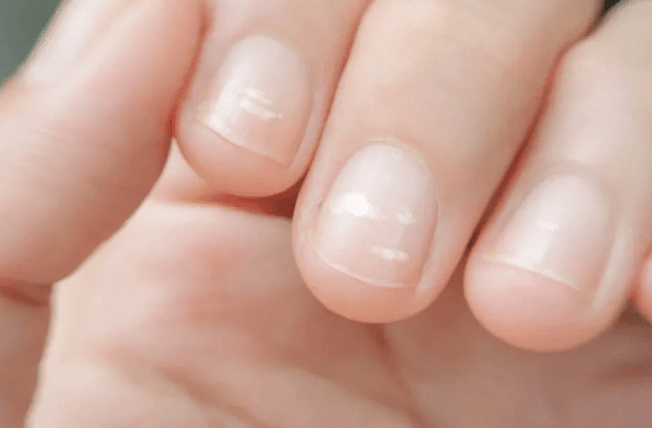 肝脏|肝脏好不好，竖起拇指就知道！若没有3个“异常”，肝脏还算干净