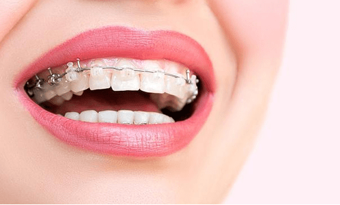 牙齿矫正的流程是怎么样的 检查