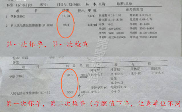 智商|盘点怀孕生娃时交过的“智商税”，希望你别中招，孕妈要“避坑”
