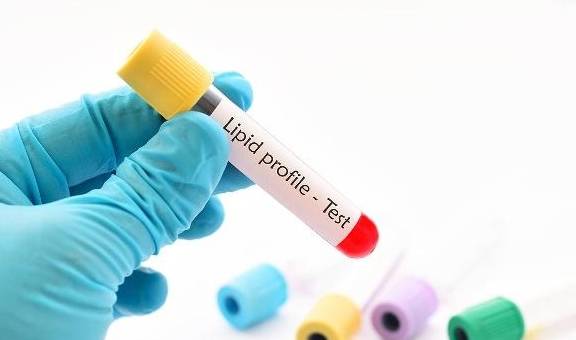 水平|血脂的正常范围是多少？这几个指标，你可别超了