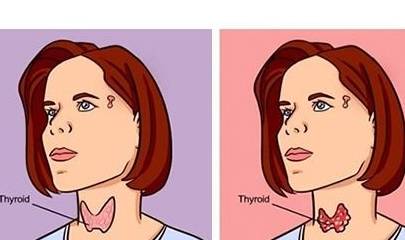 合并|糖尿病越来越瘦正常吗？警惕：5点因素是致瘦根源，尤其警觉第5点